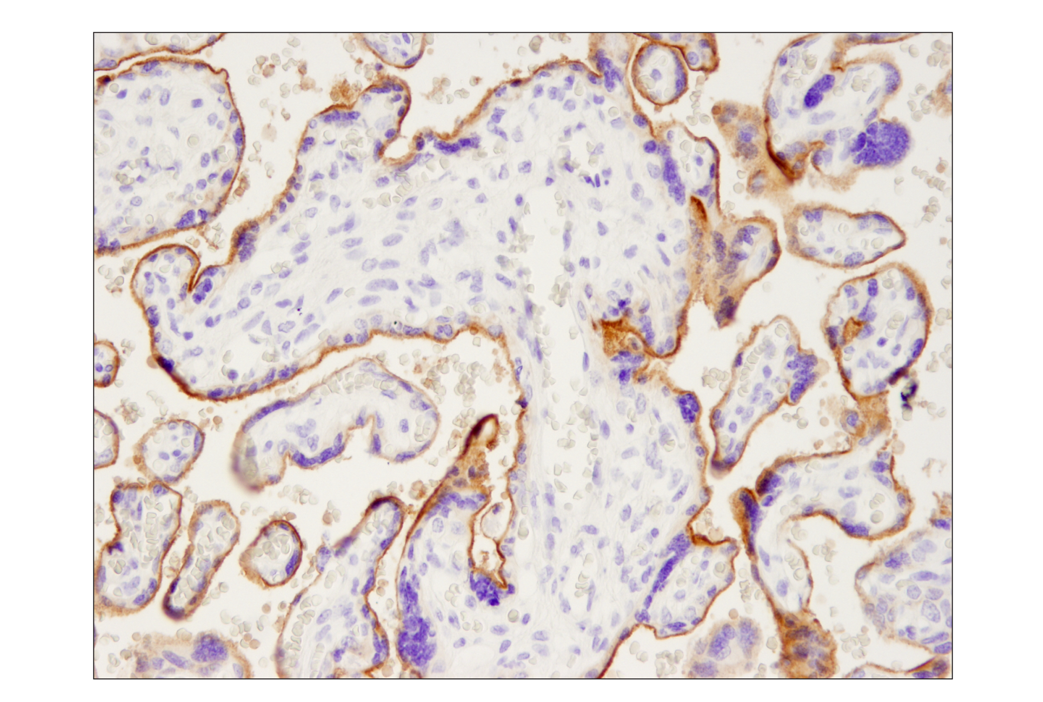 Immunohistochemistry Image 2: PD-L1 (Extracellular Domain Specific) (E1J2J™) Rabbit mAb (BSA and Azide Free)