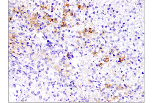 Immunohistochemistry Image 3: PD-L1 (Extracellular Domain Specific) (E1J2J™) Rabbit mAb (BSA and Azide Free)