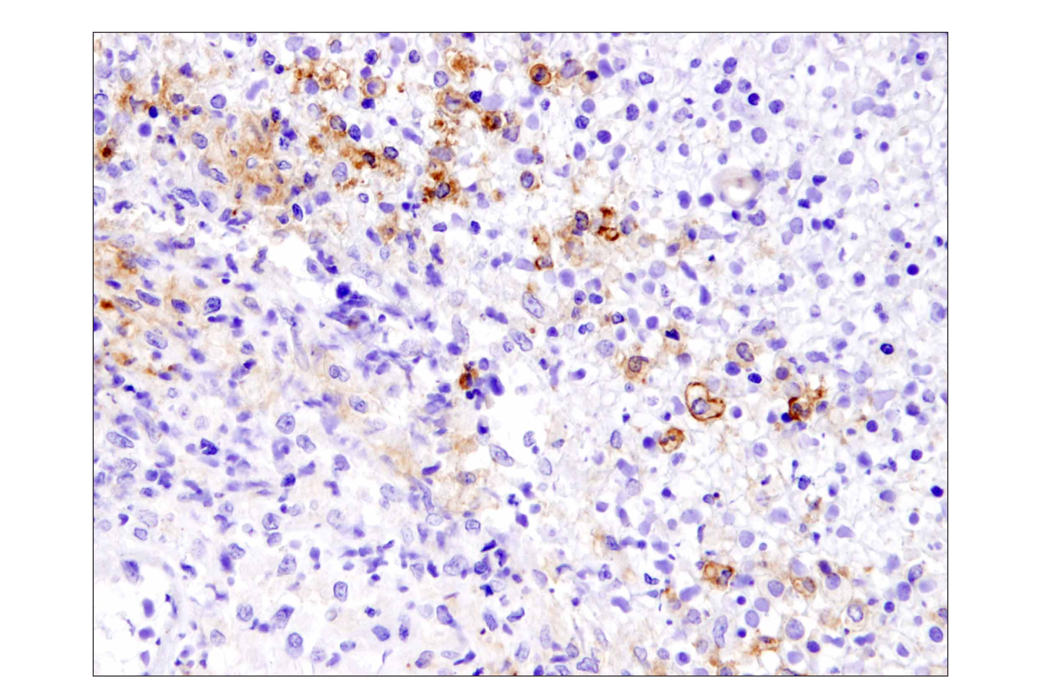 Immunohistochemistry Image 1: PD-L1 (Extracellular Domain Specific) (E1J2J™) Rabbit mAb (BSA and Azide Free)