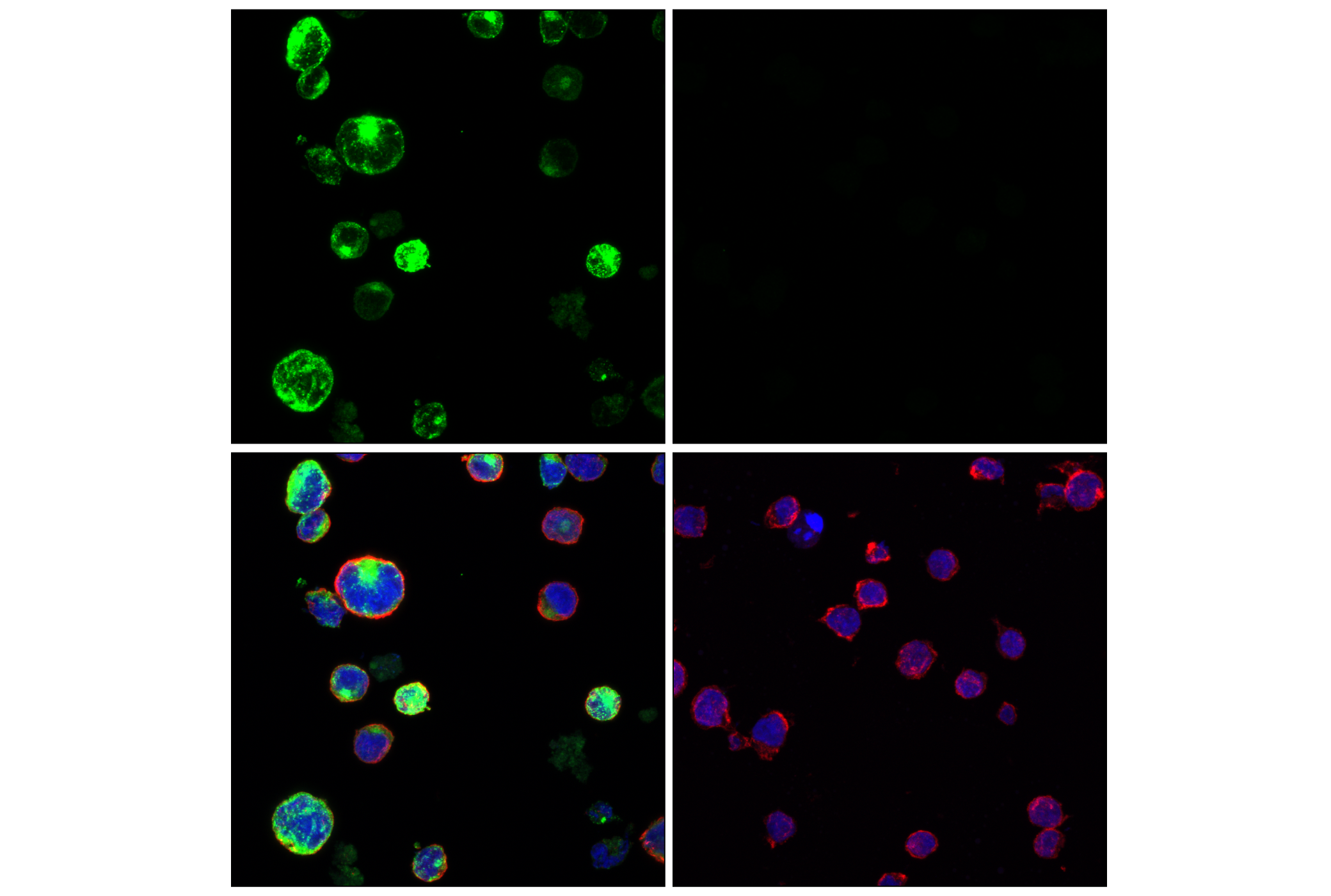 Immunofluorescence Image 1: GNLY (E3N1M) Rabbit mAb