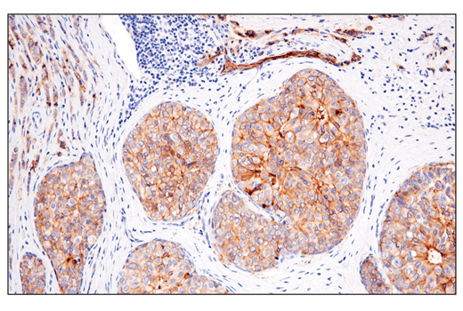 Immunohistochemistry Image 2: Occludin (E6B4R) Rabbit mAb (BSA and Azide Free)