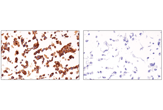 Immunohistochemistry Image 9: Occludin (E6B4R) Rabbit mAb (BSA and Azide Free)