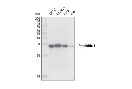  Image 4: Mitochondrial Marker Antibody Sampler Kit