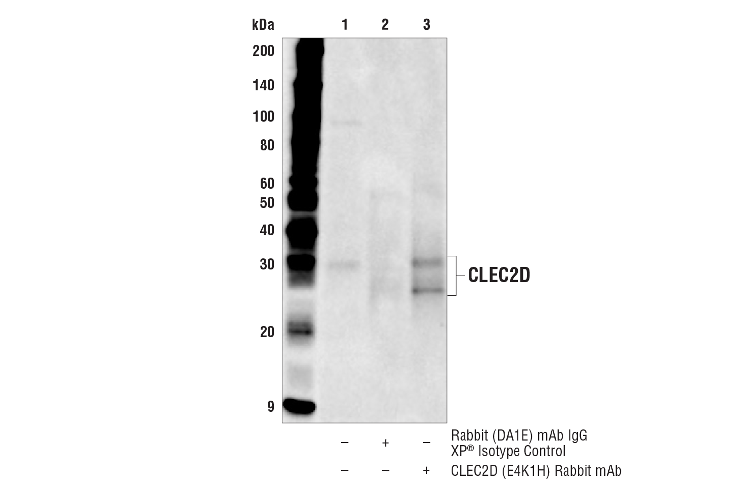 Immunoprecipitation Image 1: CLEC2D (E4K1H) Rabbit mAb