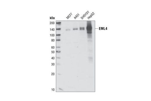 Western Blotting Image 1: EML4 Antibody