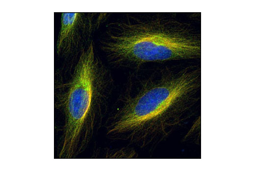 Immunofluorescence Image 1: EML4 Antibody