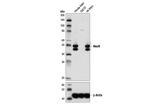  Image 5: β-Amyloid Mouse Model Neuronal Viability IF Antibody Sampler Kit