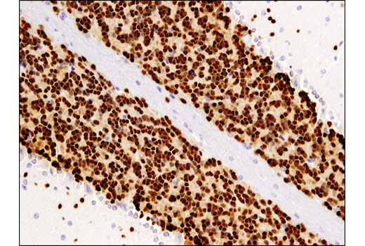  Image 14: β-Amyloid Mouse Model Neuronal Viability IF Antibody Sampler Kit