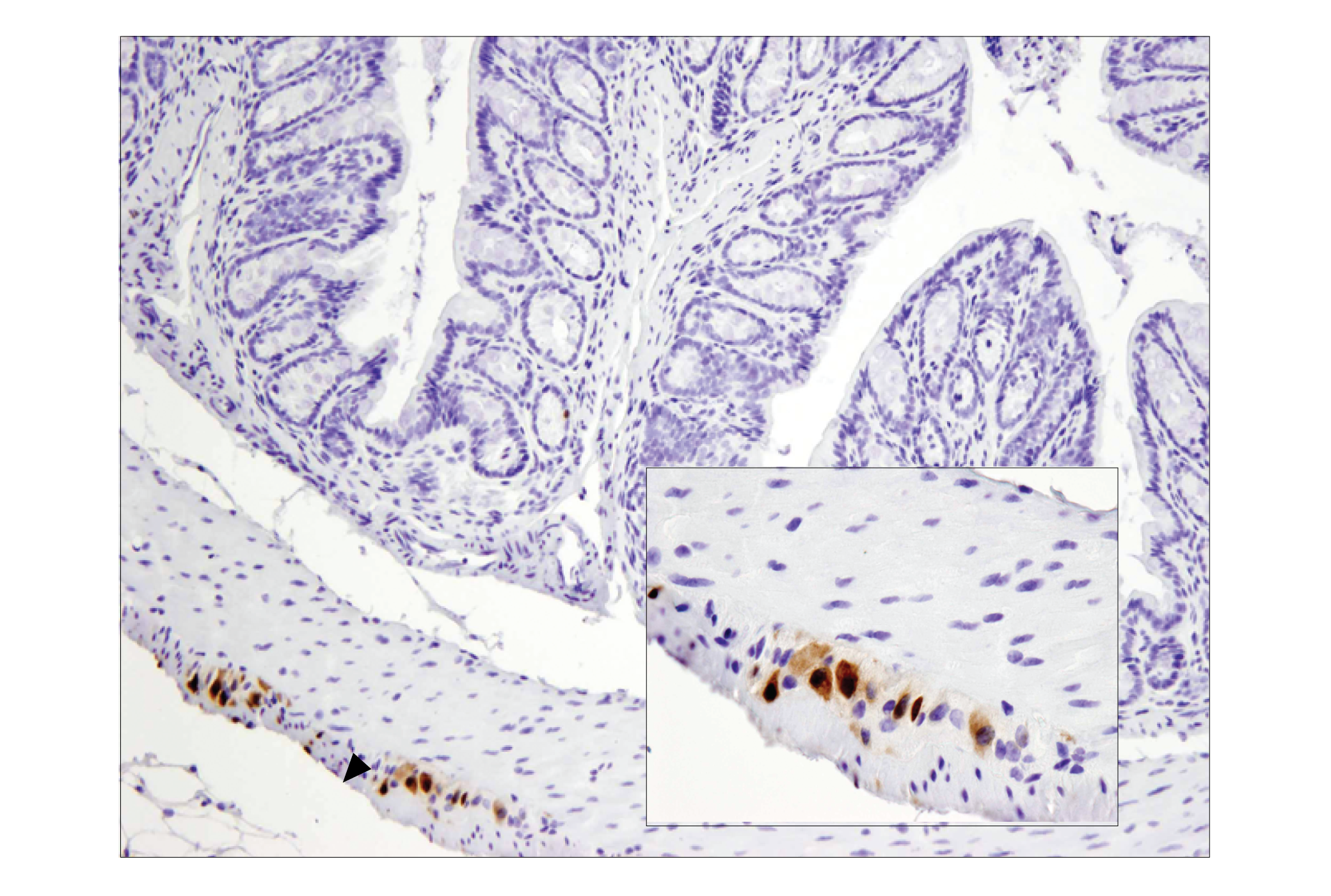  Image 33: β-Amyloid Mouse Model Neuronal Viability IF Antibody Sampler Kit