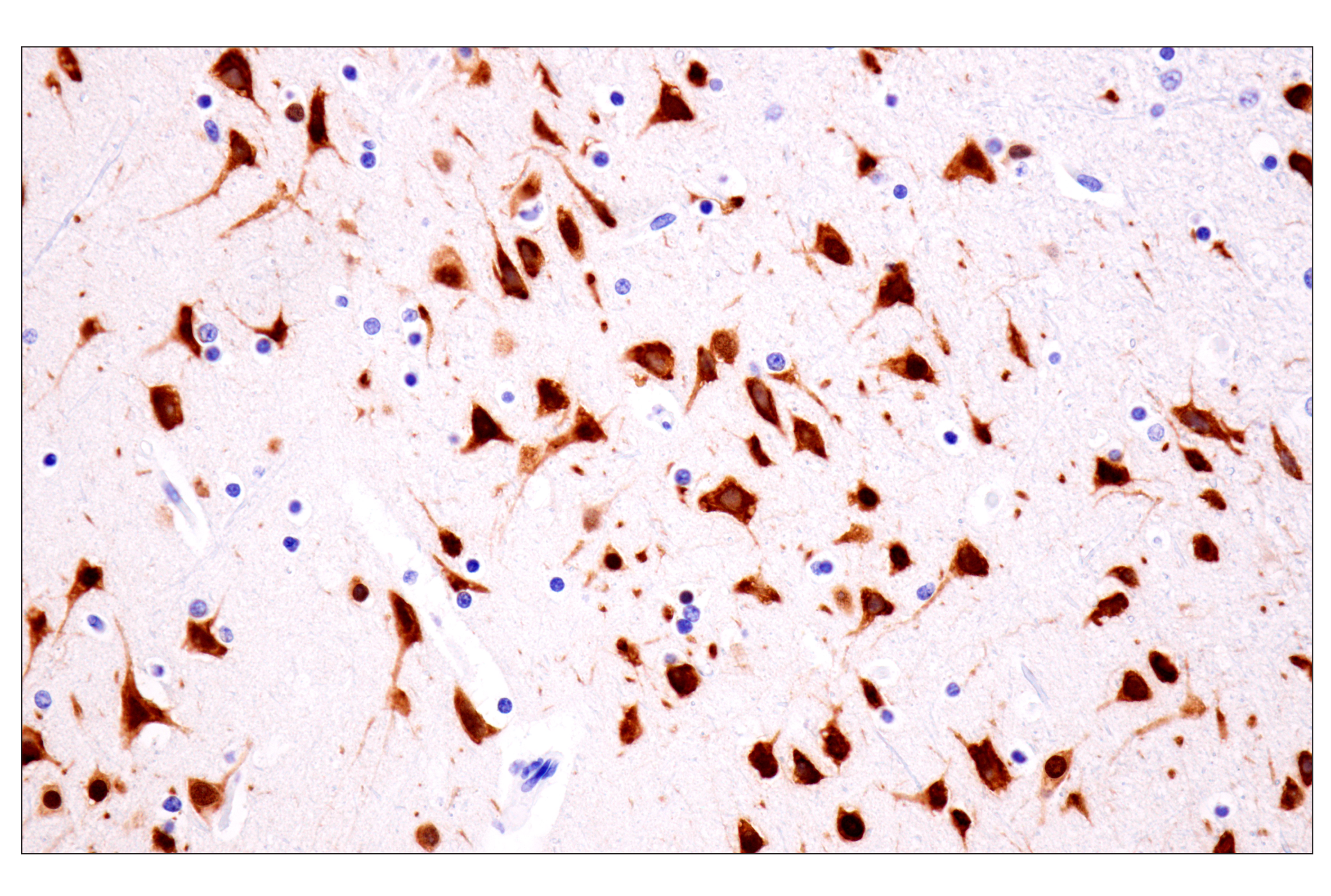  Image 28: β-Amyloid Mouse Model Neuronal Viability IF Antibody Sampler Kit