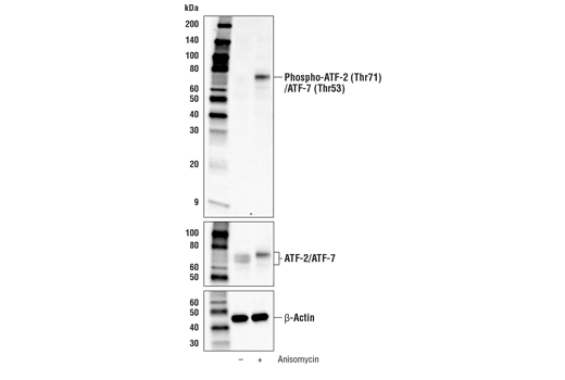 Western Blotting Image 1: Phospho-ATF-2 (Thr71)/ATF-7 (Thr53) Antibody