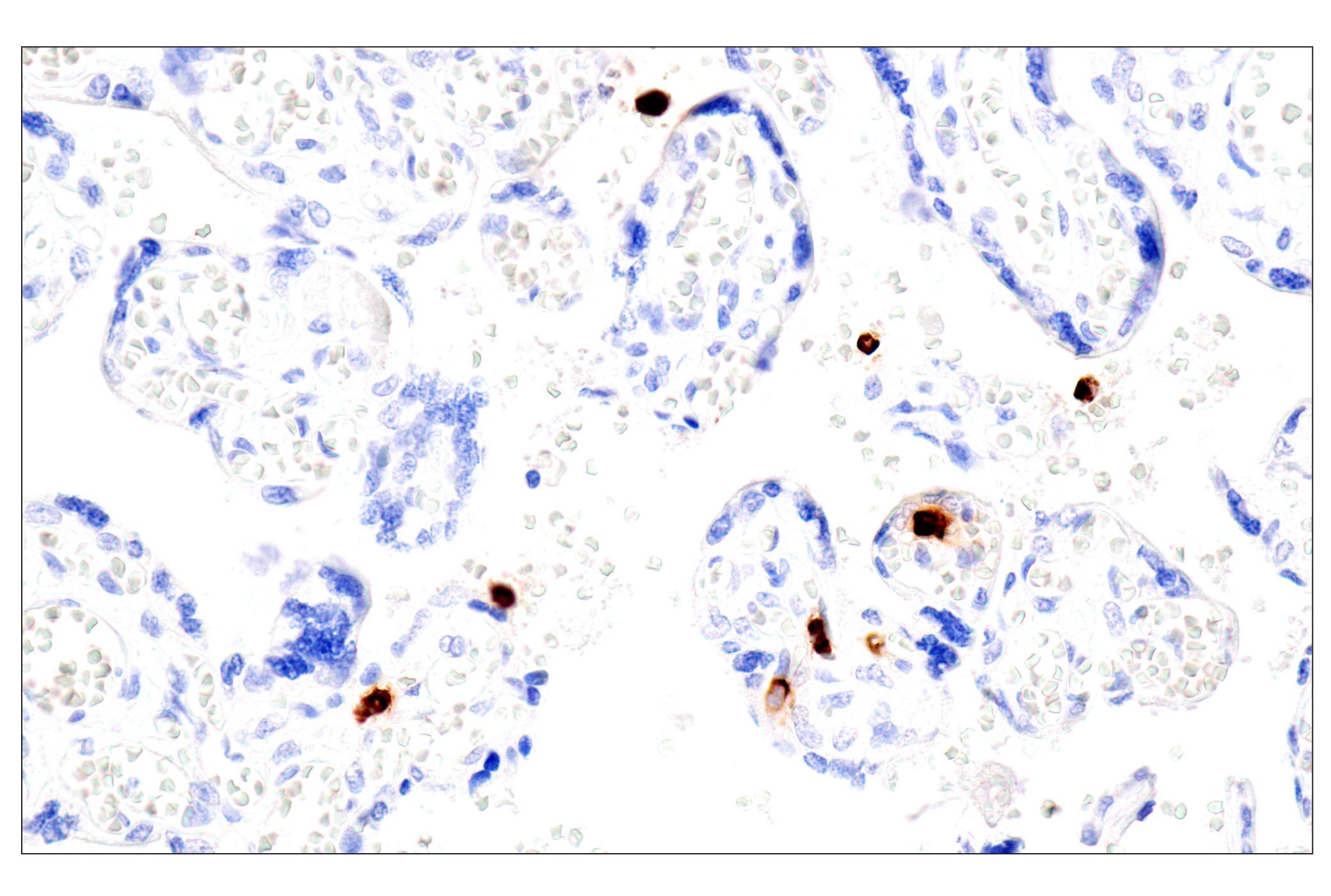 Immunohistochemistry Image 9: Eosinophil cationic protein (E6U5M) Rabbit mAb
