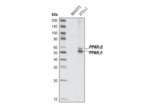  Image 1: PPARγ Regulated Fatty Acid Metabolism Antibody Sampler Kit