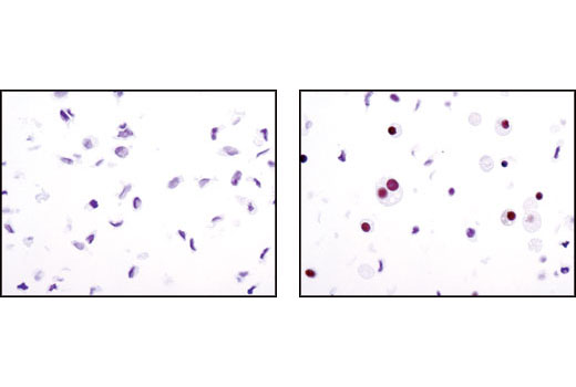 Immunohistochemistry Image 1: PPARγ (C26H12) Rabbit mAb