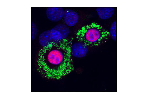 Immunofluorescence Image 1: PPARγ (C26H12) Rabbit mAb