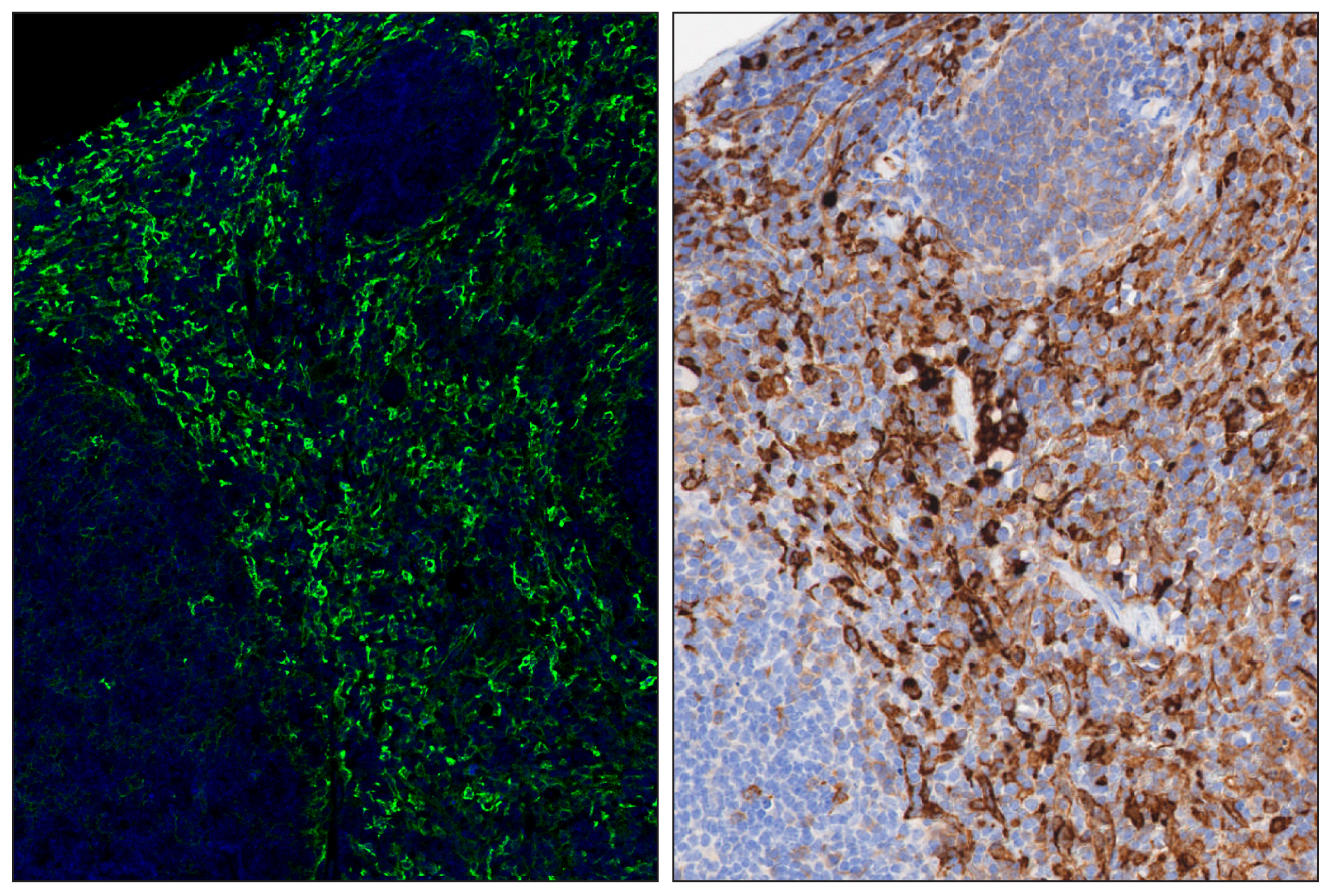 Immunohistochemistry Image 6: CD206/MRC1 (E6T5J) & CO-0032-750 SignalStar™ Oligo-Antibody Pair