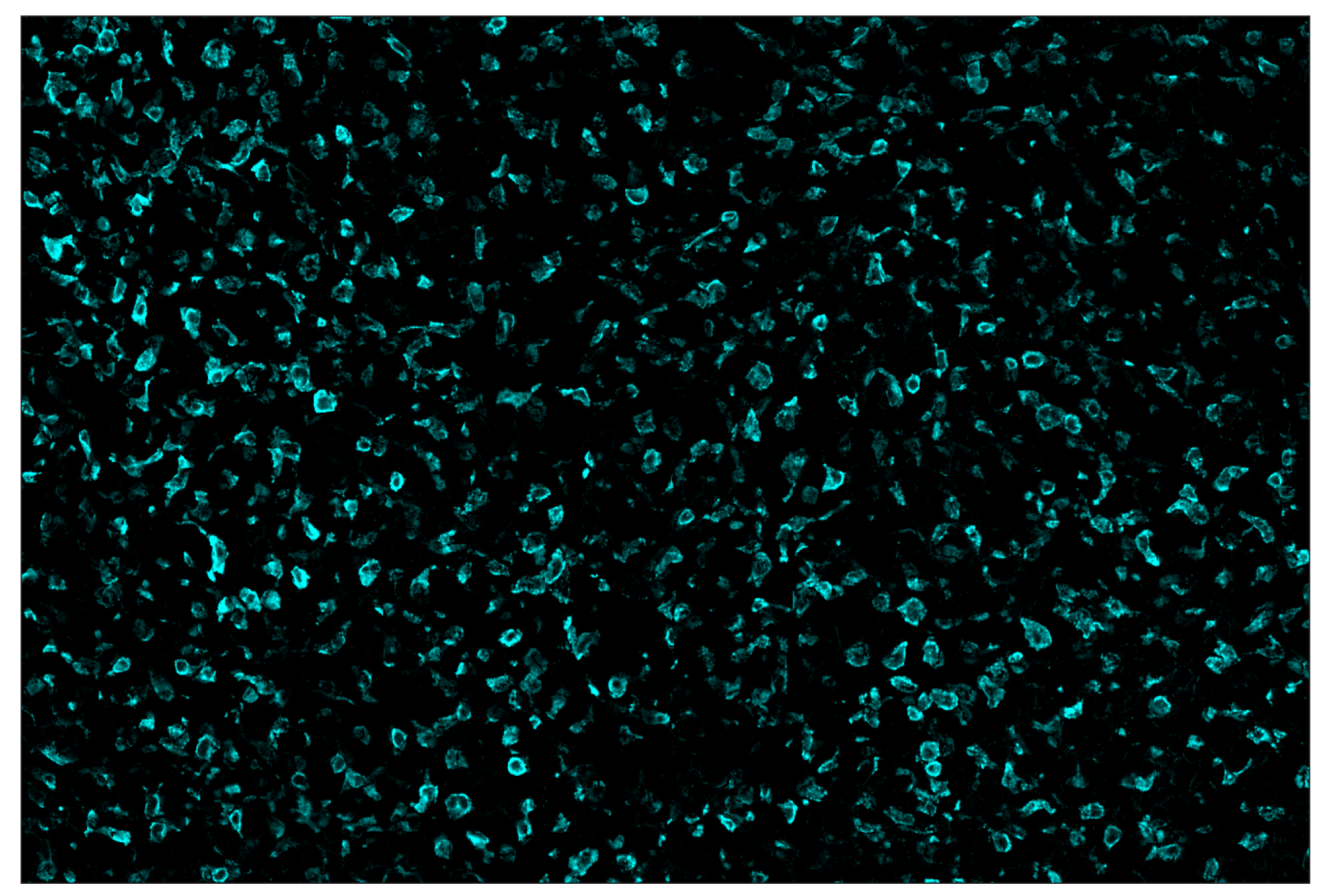 Immunohistochemistry Image 5: CD206/MRC1 (E6T5J) & CO-0032-488 SignalStar™ Oligo-Antibody Pair