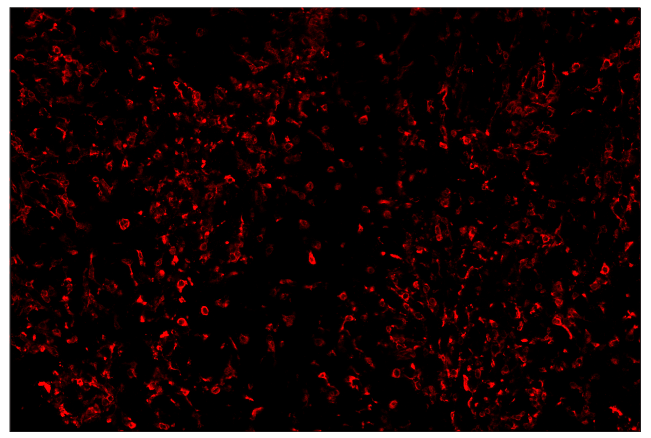 Immunohistochemistry Image 4: CD206/MRC1 (E6T5J) & CO-0032-594 SignalStar™ Oligo-Antibody Pair