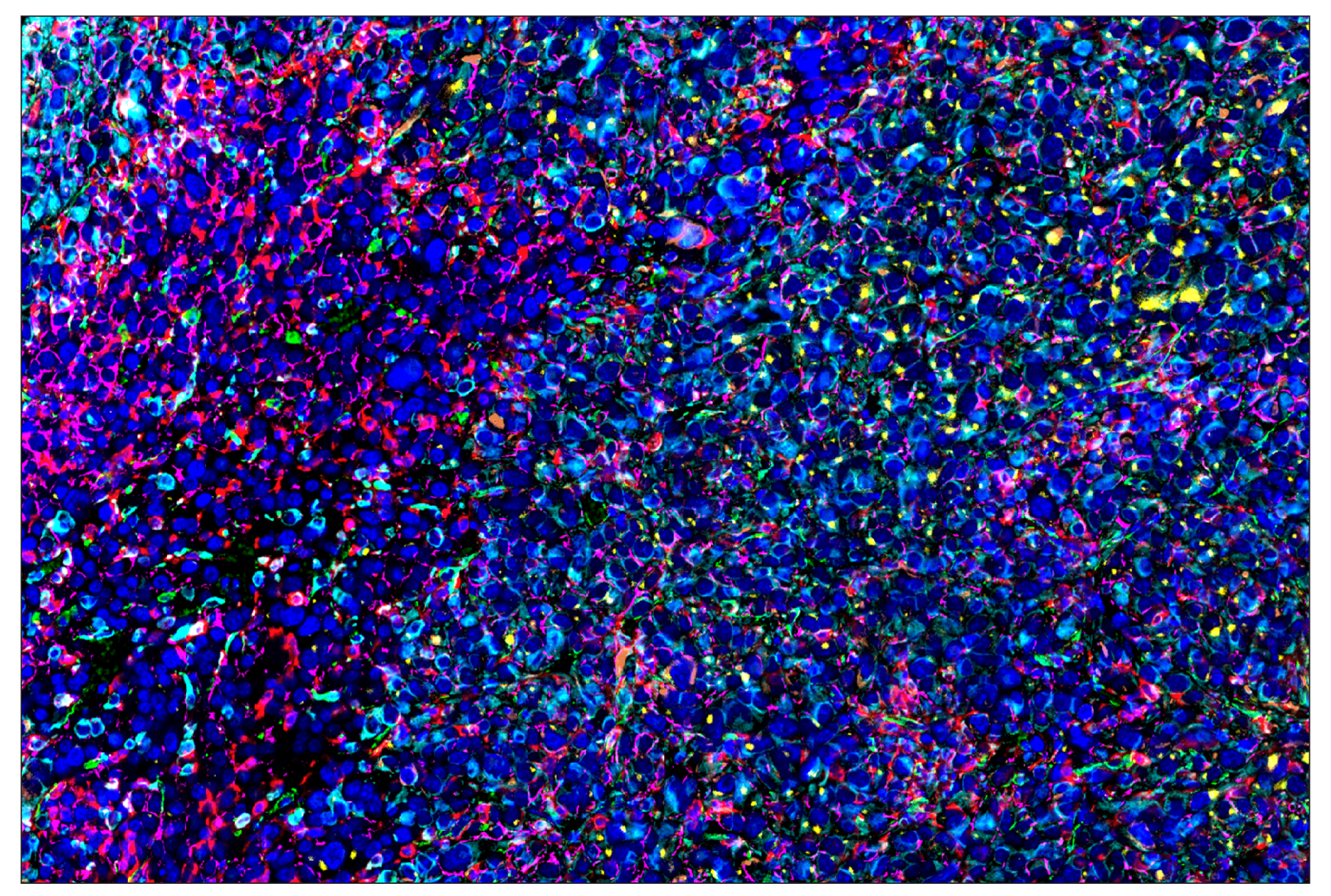 Immunohistochemistry Image 1: CD206/MRC1 (E6T5J) & CO-0032-750 SignalStar™ Oligo-Antibody Pair
