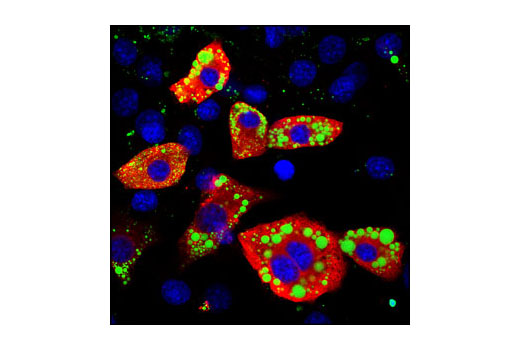 Immunofluorescence Image 1: SCD1 (M38) Antibody