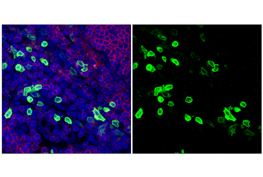 Immunofluorescence Image 1: NK1.1/CD161 (E6Y9G) Rabbit mAb (BSA and Azide Free)