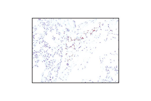 Immunohistochemistry Image 3: ATGL (30A4) Rabbit mAb