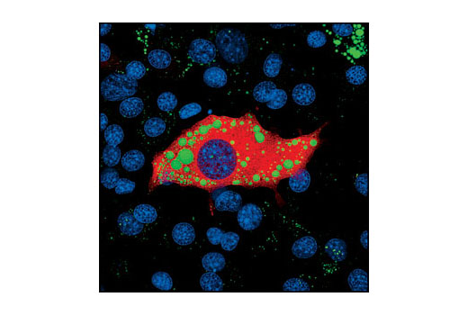 Immunofluorescence Image 1: ATGL (30A4) Rabbit mAb