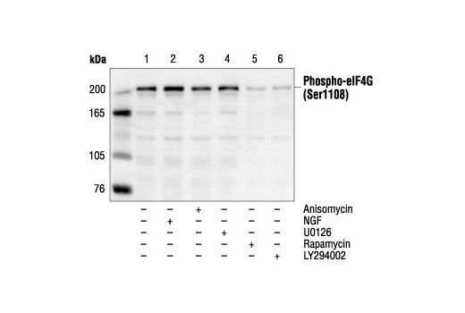  Image 12: Translation Initiation Complex Antibody Sampler Kit