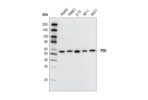 Western Blotting Image 1: PDI Antibody