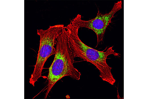 Immunofluorescence Image 1: PDI Antibody