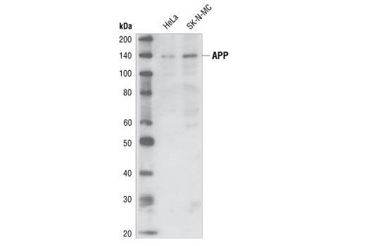 Western Blotting Image 1: APP/β-Amyloid (NAB228) Mouse mAb
