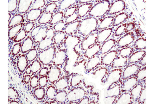 Immunohistochemistry Image 1: Histone H2A.X (D17A3) XP® Rabbit mAb (BSA and Azide Free)