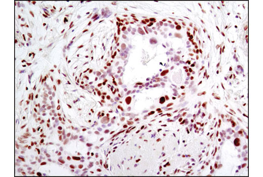 Immunohistochemistry Image 2: Histone H2A.X (D17A3) XP® Rabbit mAb (BSA and Azide Free)