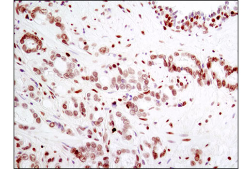 Immunohistochemistry Image 3: Histone H2A.X (D17A3) XP® Rabbit mAb (BSA and Azide Free)