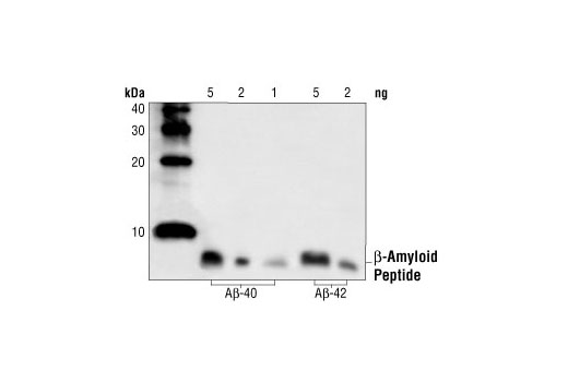 Western Blotting Image 1: β-Amyloid Antibody