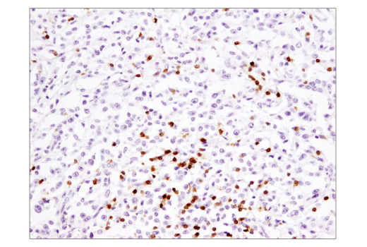Immunohistochemistry Image 2: CD3ε (D7A6E™) XP® Rabbit mAb (BSA and Azide Free)
