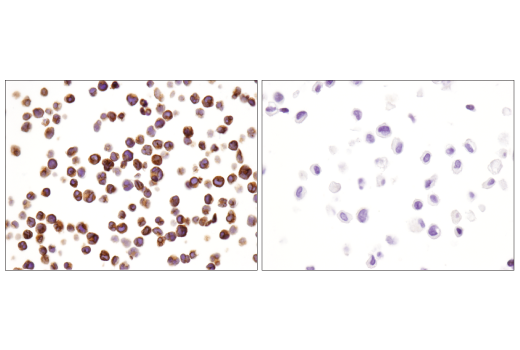 Immunohistochemistry Image 4: CD3ε (D7A6E™) XP® Rabbit mAb (BSA and Azide Free)