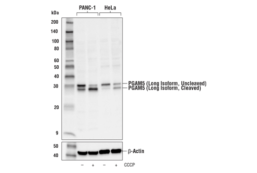Western Blotting Image 1: PGAM5 (Long Isoform) Antibody