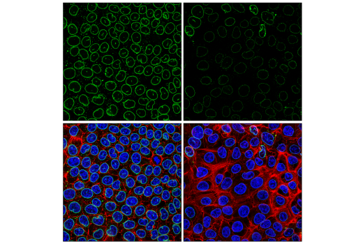 Immunofluorescence Image 1: NUP62 (E4Y5P) Rabbit mAb