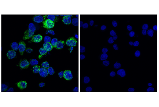 Immunofluorescence Image 4: CD206/MRC1 (E6T5J) XP® Rabbit mAb