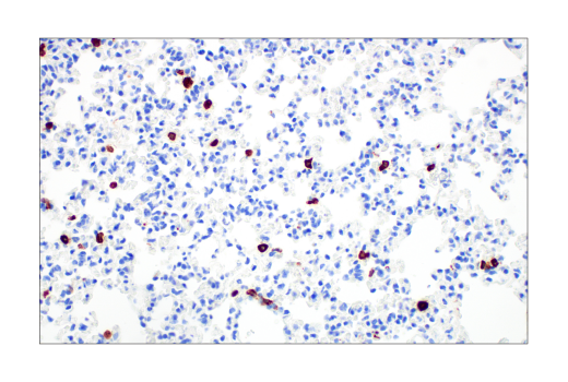  Image 29: Mouse Reactive M1 vs M2 Macrophage IHC Antibody Sampler Kit