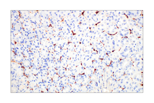 Immunohistochemistry Image 3: CD206/MRC1 (E6T5J) XP® Rabbit mAb
