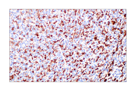 Immunohistochemistry Image 4: CD206/MRC1 (E6T5J) XP® Rabbit mAb