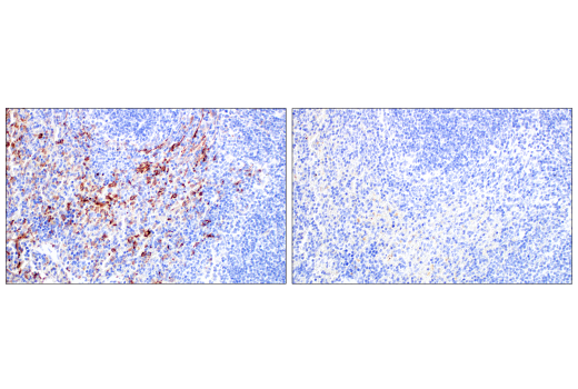 Immunohistochemistry Image 10: CD206/MRC1 (E6T5J) XP® Rabbit mAb