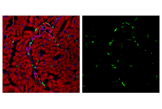 Immunofluorescence Image 1: CD206/MRC1 (E6T5J) XP® Rabbit mAb