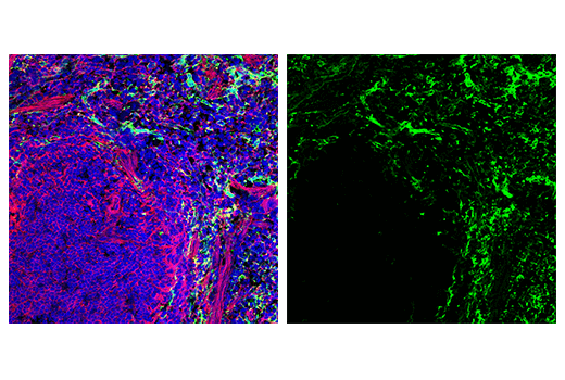 Immunofluorescence Image 2: CD206/MRC1 (E6T5J) XP® Rabbit mAb