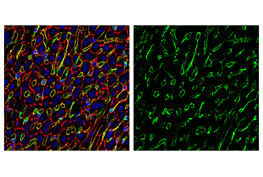 Immunofluorescence Image 3: CD206/MRC1 (E6T5J) XP® Rabbit mAb