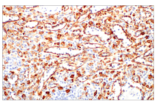 Immunohistochemistry Image 12: CD206/MRC1 (E6T5J) XP® Rabbit mAb