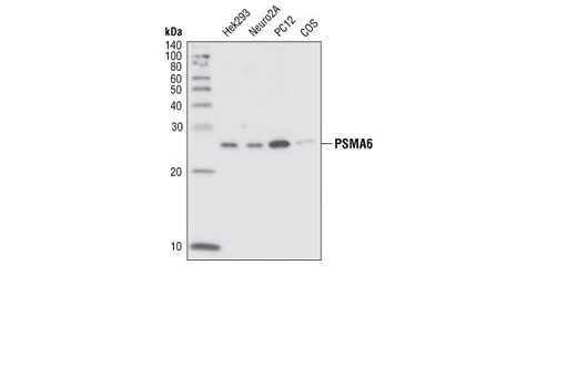 Western Blotting Image 1: PSMA6 Antibody