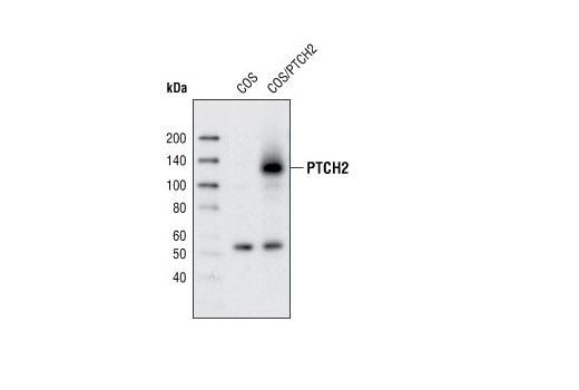 Western Blotting Image 1: PTCH2 (L849) Antibody